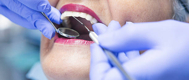 Best Emergency Treatment for Dental Infections or Abscesses in Cornwells Heights, PA